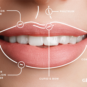 lipfiller-1