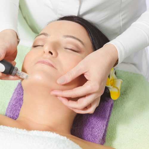 Micro needling 3